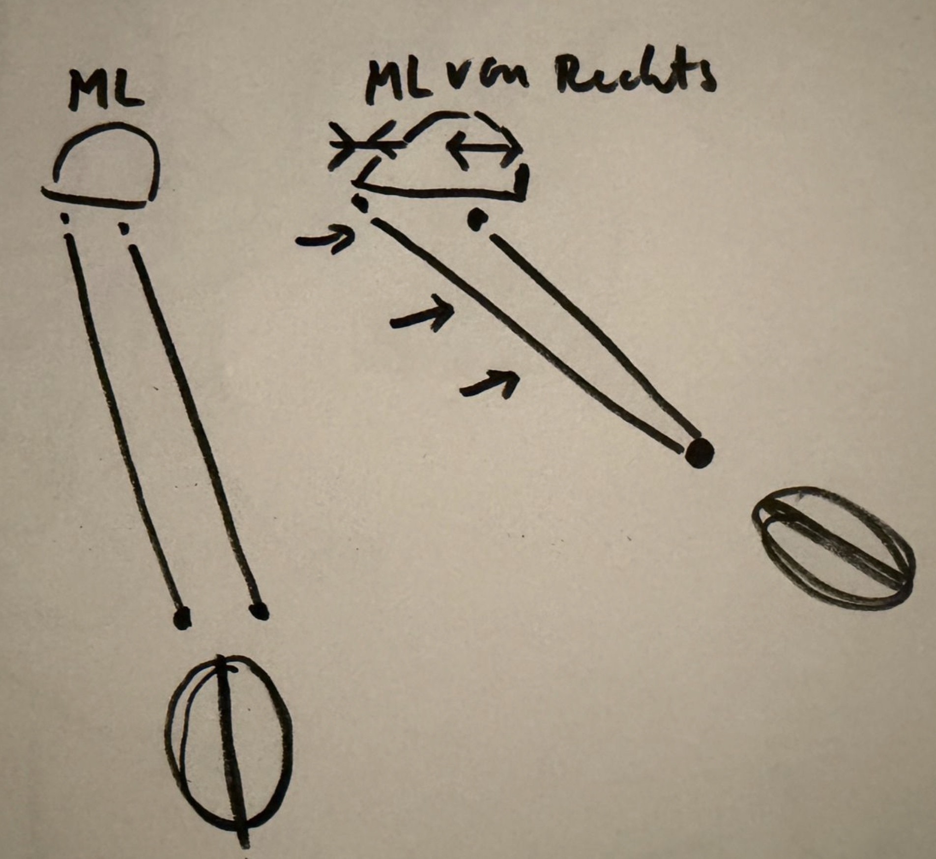 ML frontal, ML from the right. The far side of the head has to go somewhere.